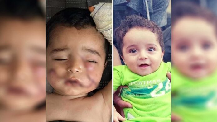 palestinian-child-injured-by-israeli-attack
