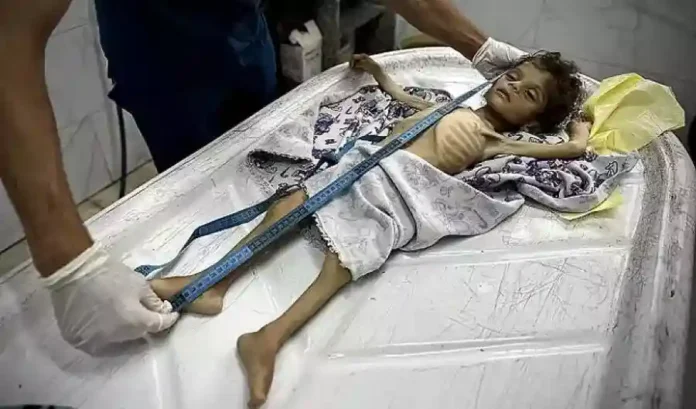 গাজায় বর্বর ইসরায়েলি হামলায় নিহত অন্তত ৭০, ক্ষুধা-অপুষ্টিতে মৃত্যু ১১ জনের copy